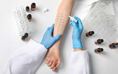 Skin Prick Test for Inhalant Allergens